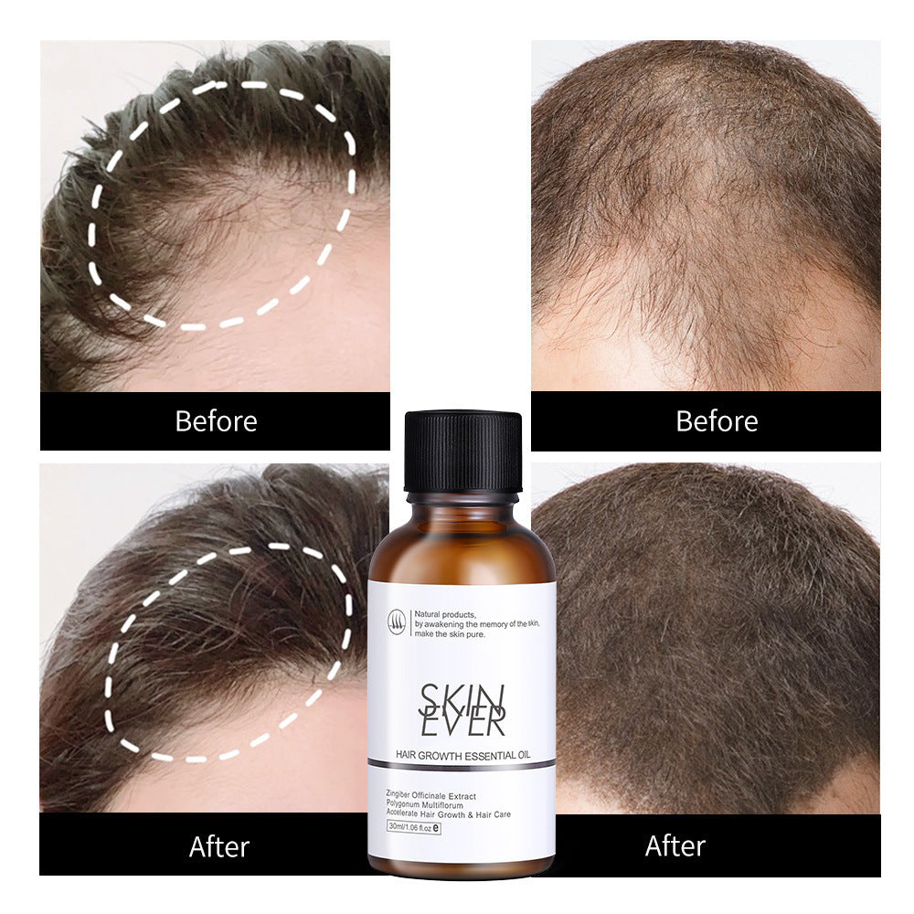 Plant Extract Scalp Care Lotion